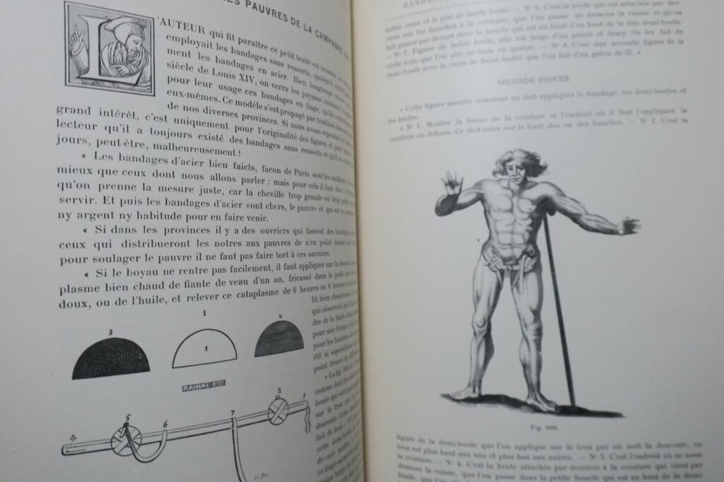 ヘルニア包帯の歴史と近代技術(1899年)