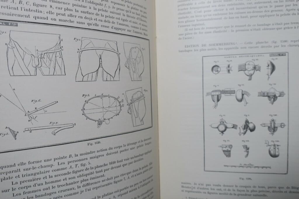 Hernia Bandages: Past and Present