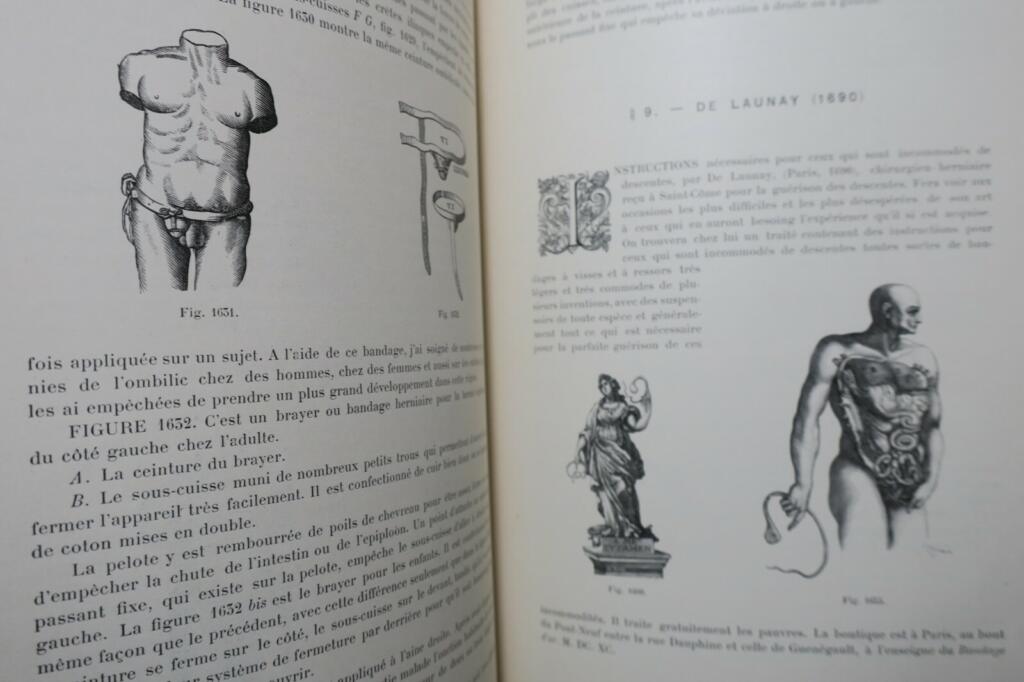 ヘルニア包帯の歴史と近代技術(1899年)