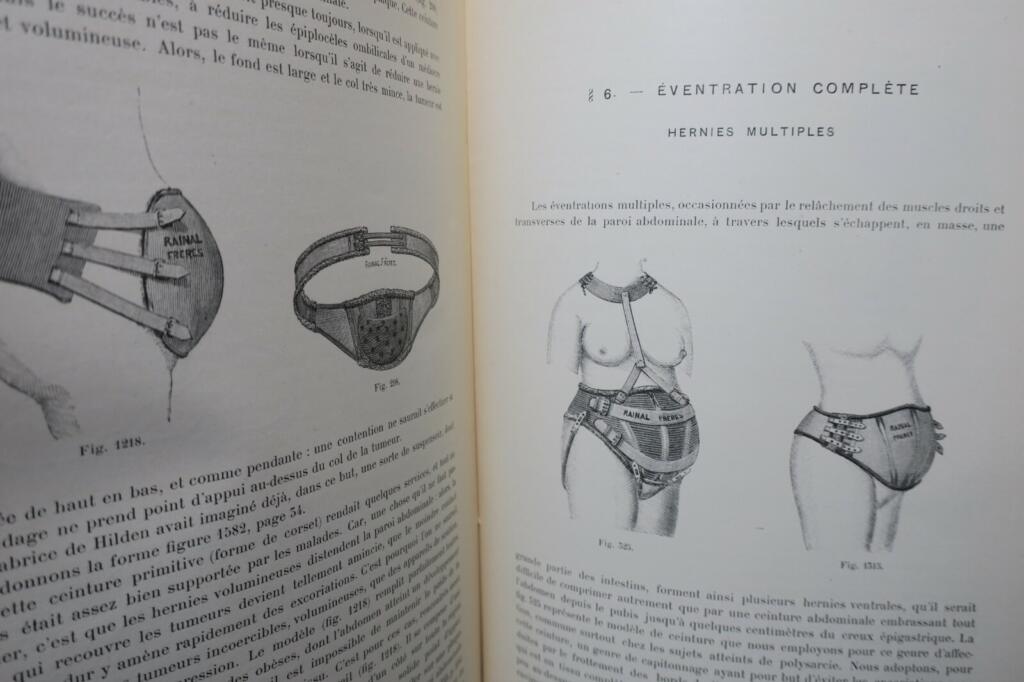 Hernia Bandages: Past and Present
