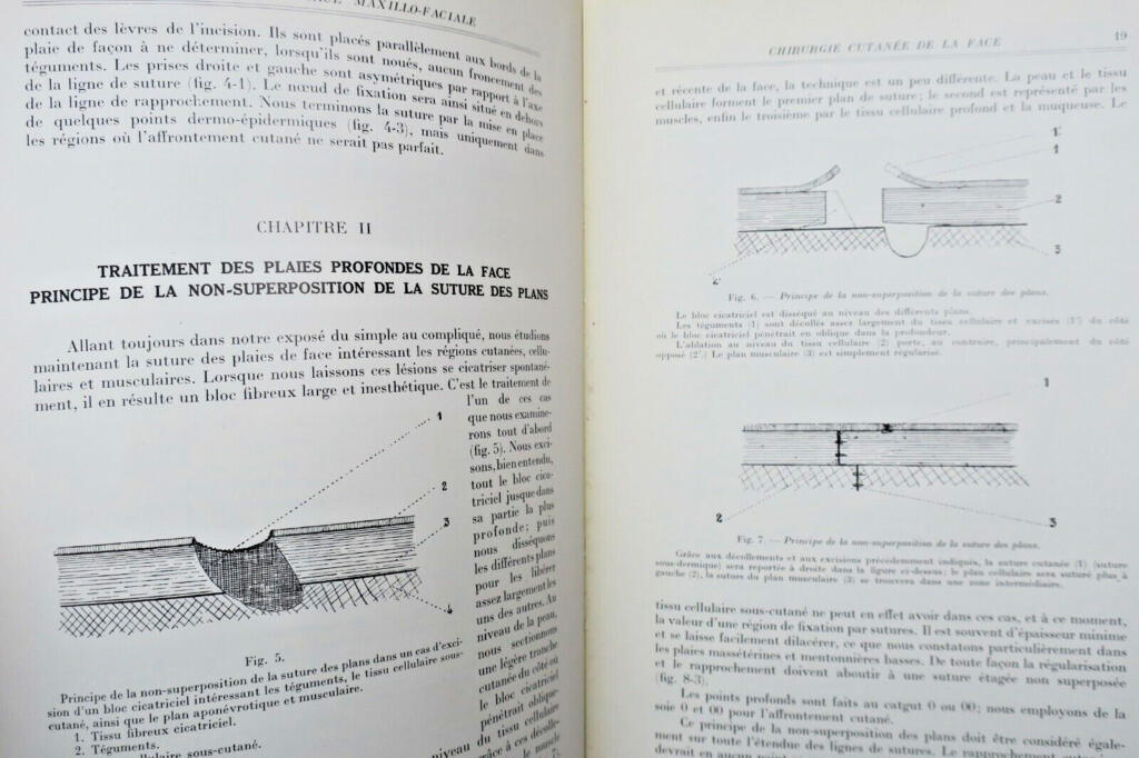 Chirurgie réparatrice maxillo-faciale. Autoplasties – Prothèse – 1940