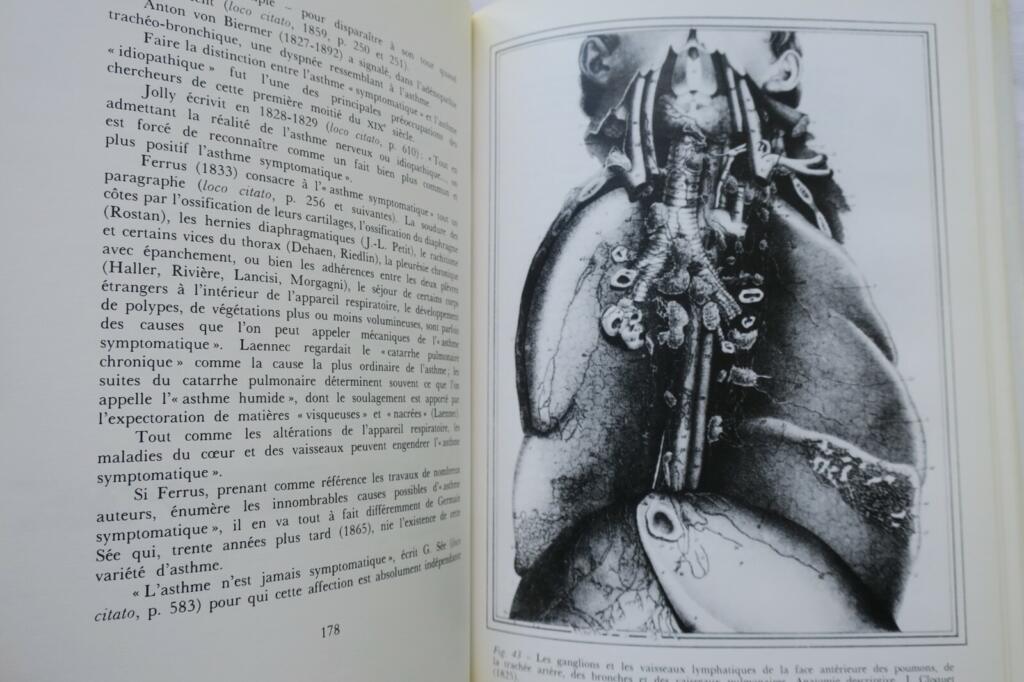Illustrated History of Asthma