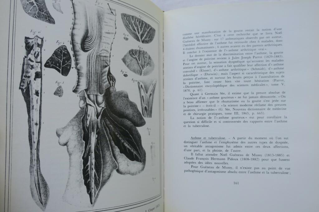 Illustrated History of Asthma