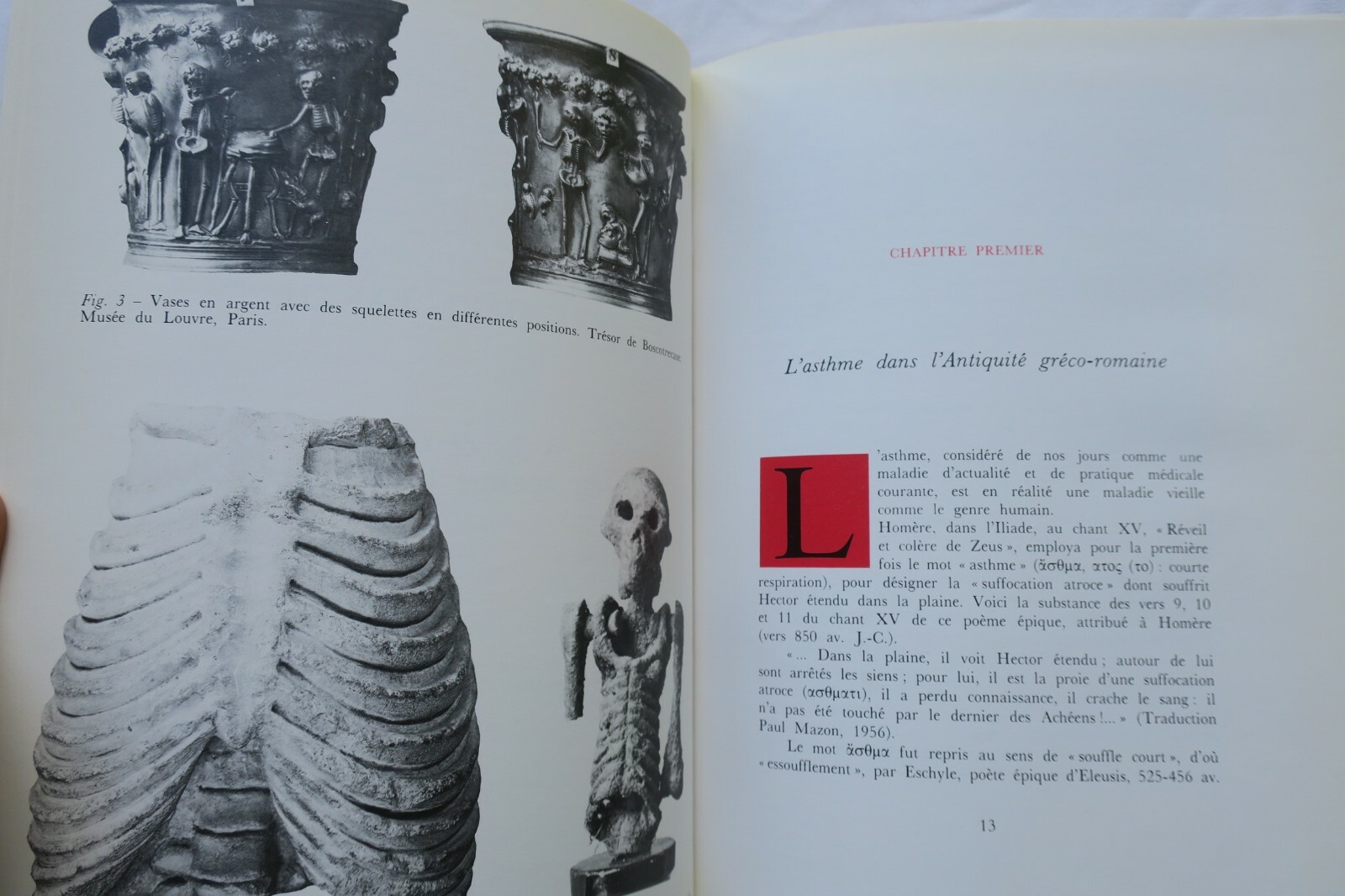 Illustrierte Geschichte des Asthmas durch die Jahrhunderte - Image 9