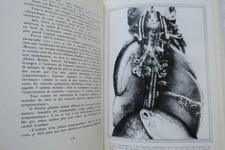 Illustrierte Geschichte des Asthmas von der Antike bis heute - Image 5