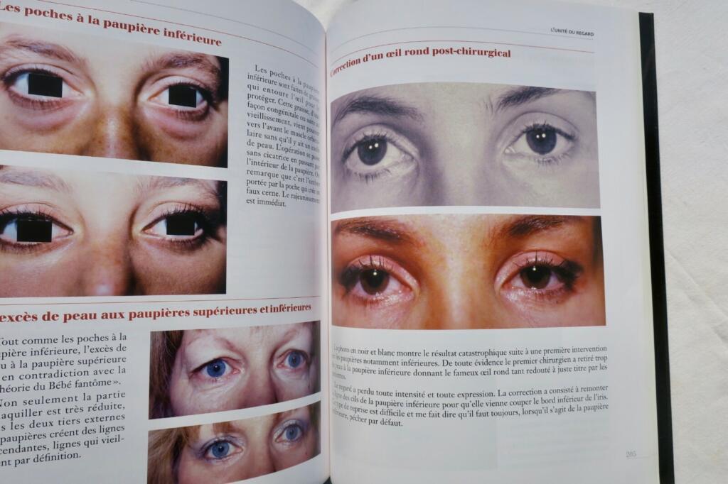 Beauté Mise en Equation – Chirurgie esthétique