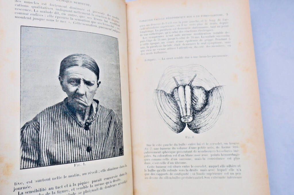Charcot Archives de Neurologie – Revue des Maladies nerveuses et mentales