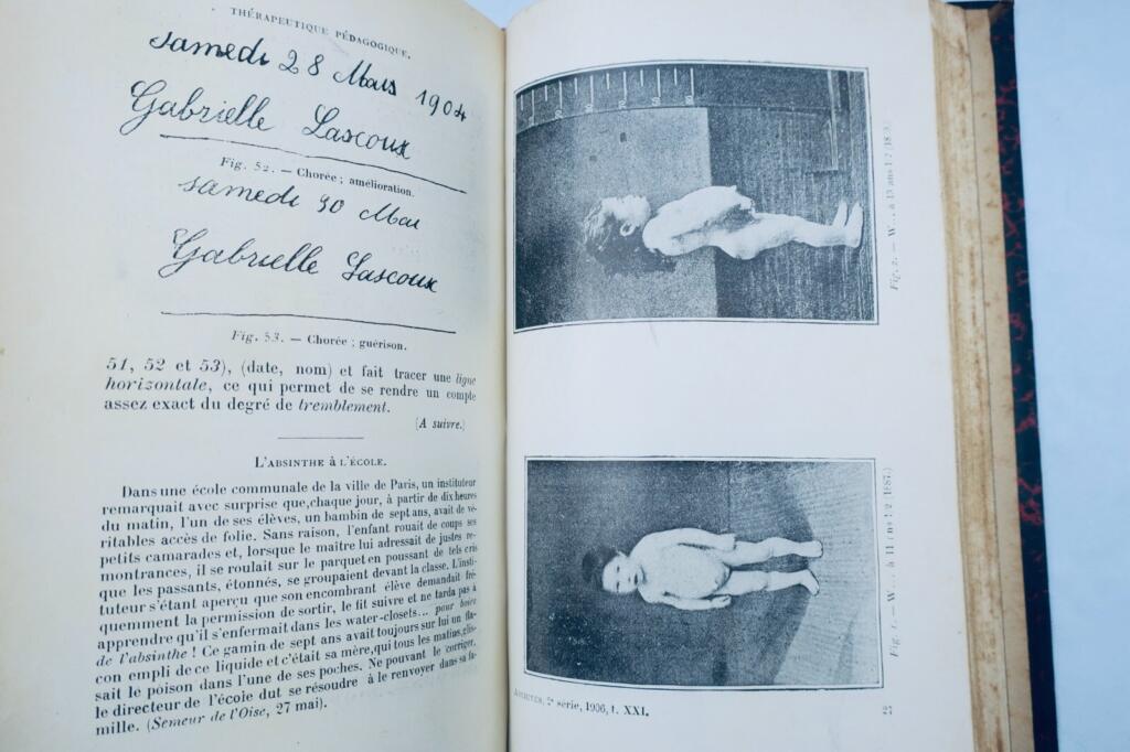 Charcot Archives de Neurologie – Revue des Maladies nerveuses et mentales
