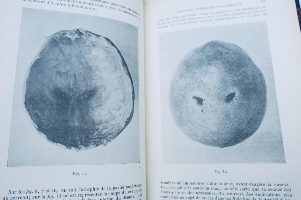 Critical archives on neurology