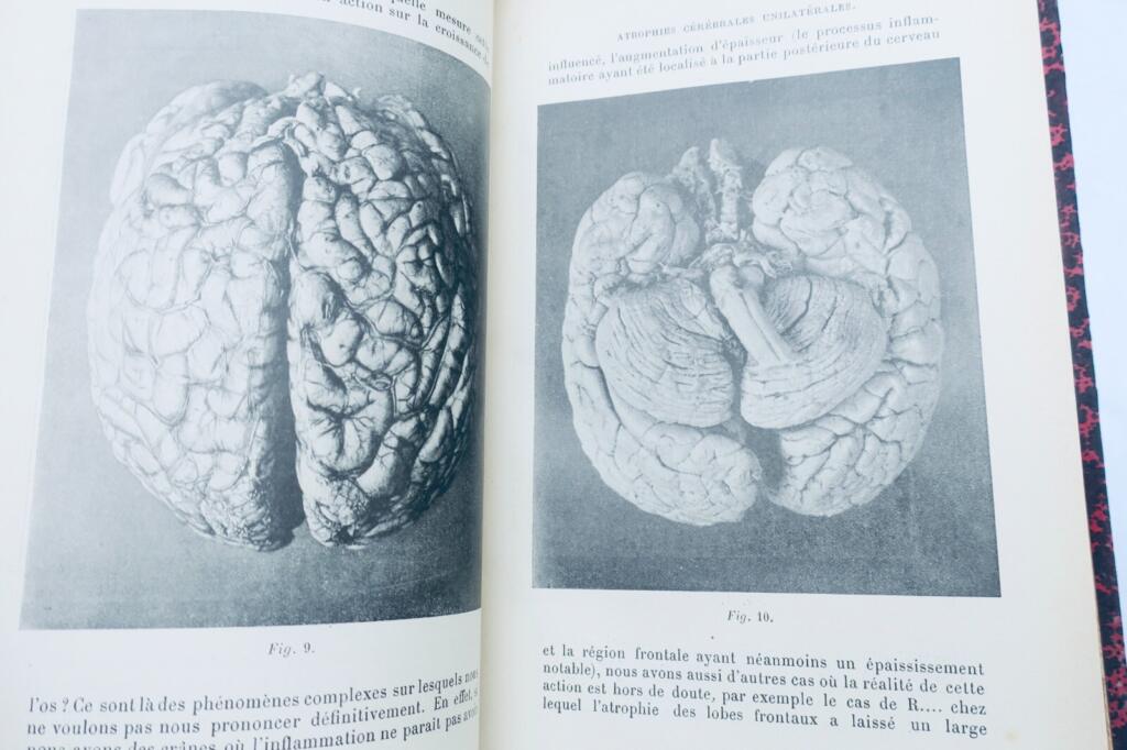 Critical archives on neurology