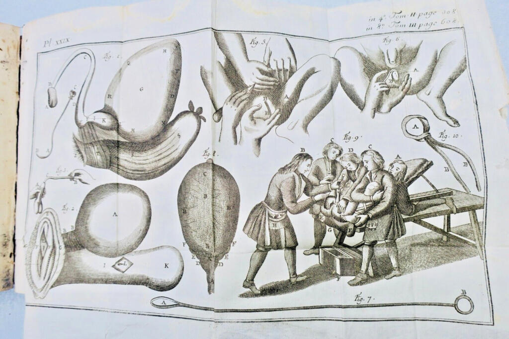 Chirurgie Laurent HEISTER Institutionen der Chirurgie 1770