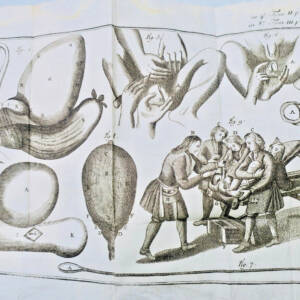 Surgical treatise with anatomical plates
