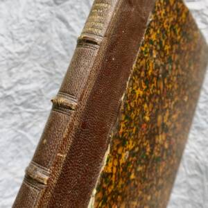 chirurgie MEMOIRES SUR LA GALVANOCAUSTIQUE THERMIQUE 1876