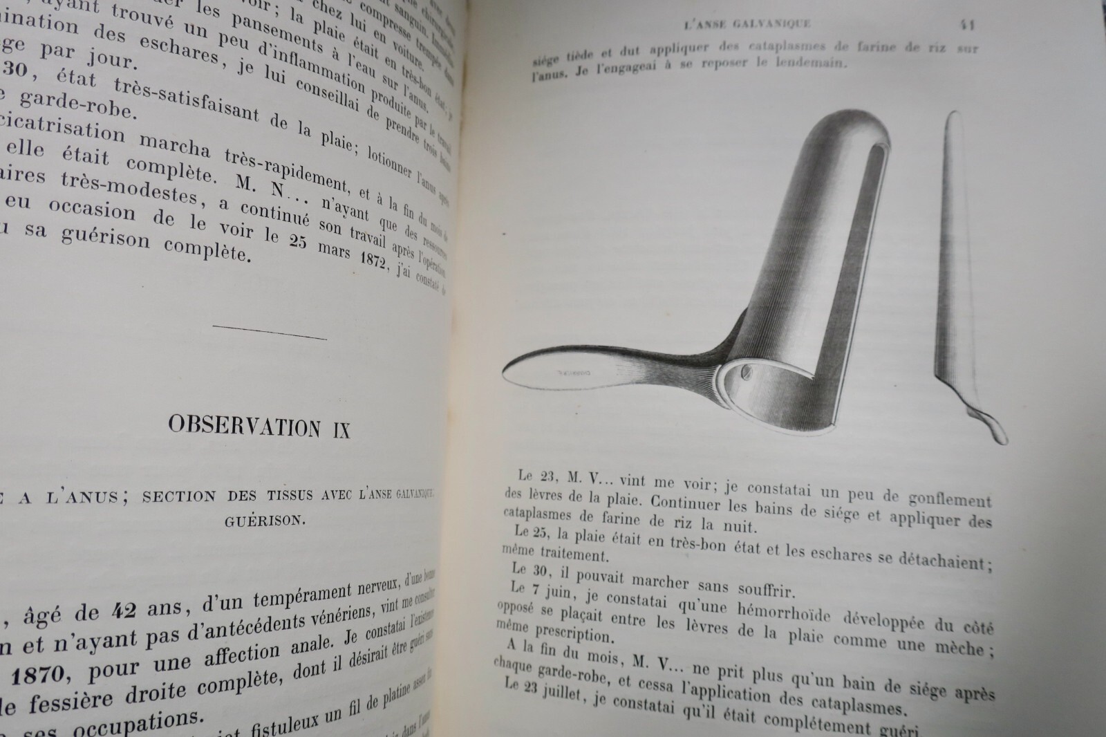 Thermal galvanocaustic surgical memoirs - Image 5