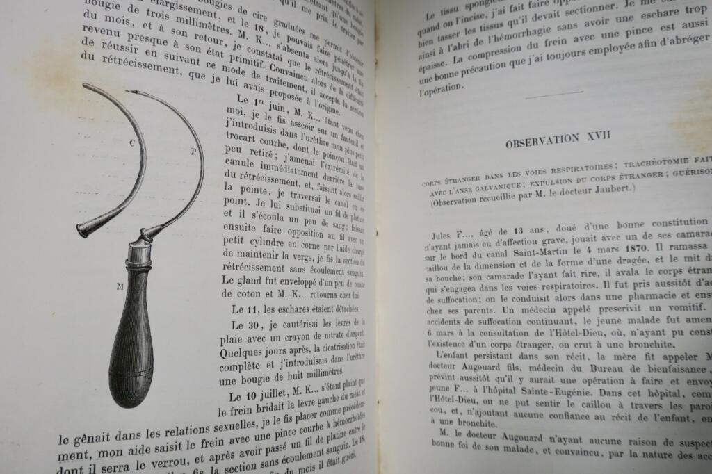 Surgical Memoirs on Thermal Galvanocausty