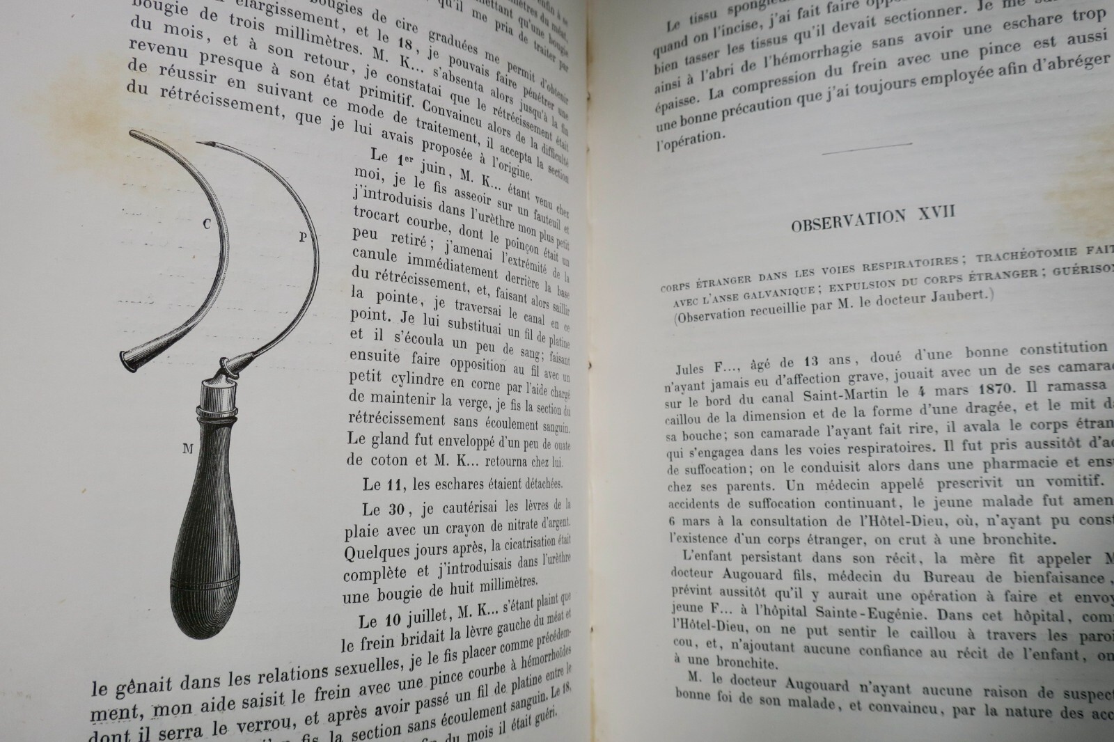 Thermal galvanocaustic surgical memoirs - Image 4