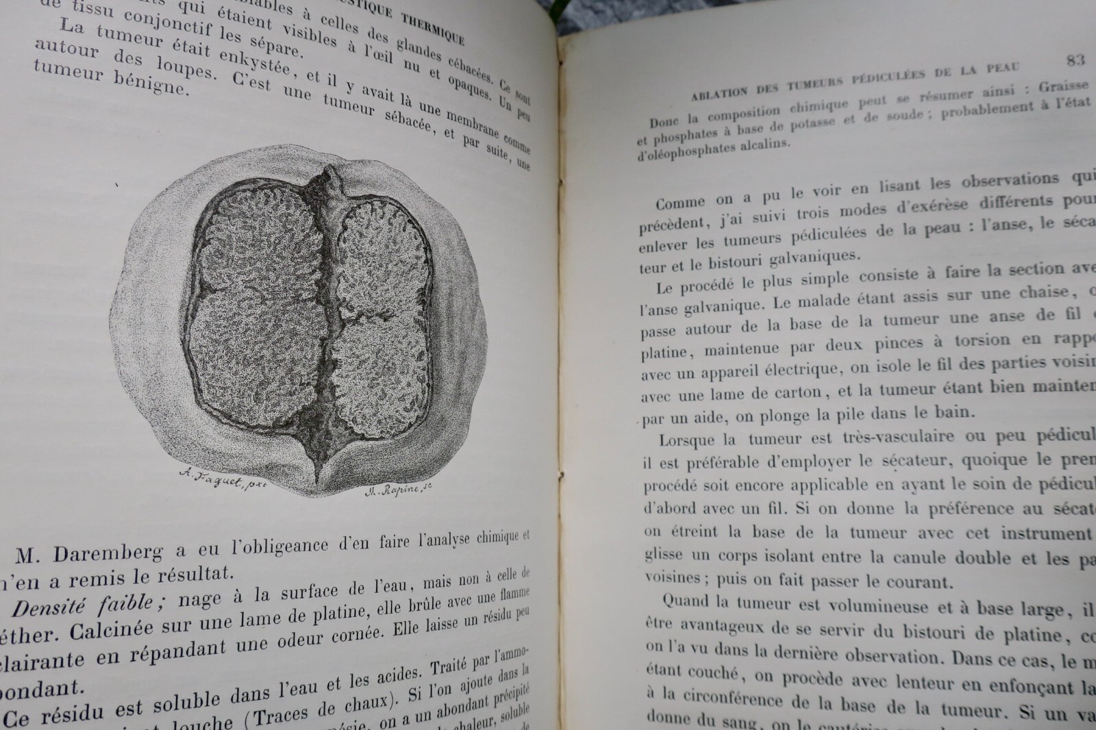 Thermal galvanocaustic surgical memoirs - Image 3