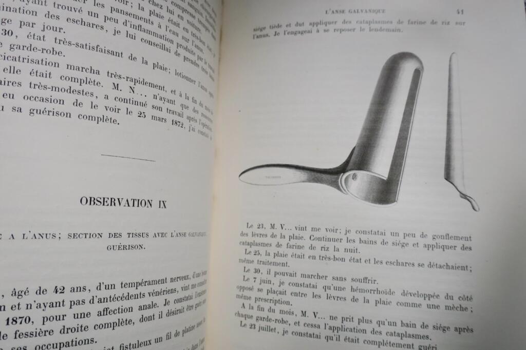 Surgical Memoirs on Thermal Galvanocausty