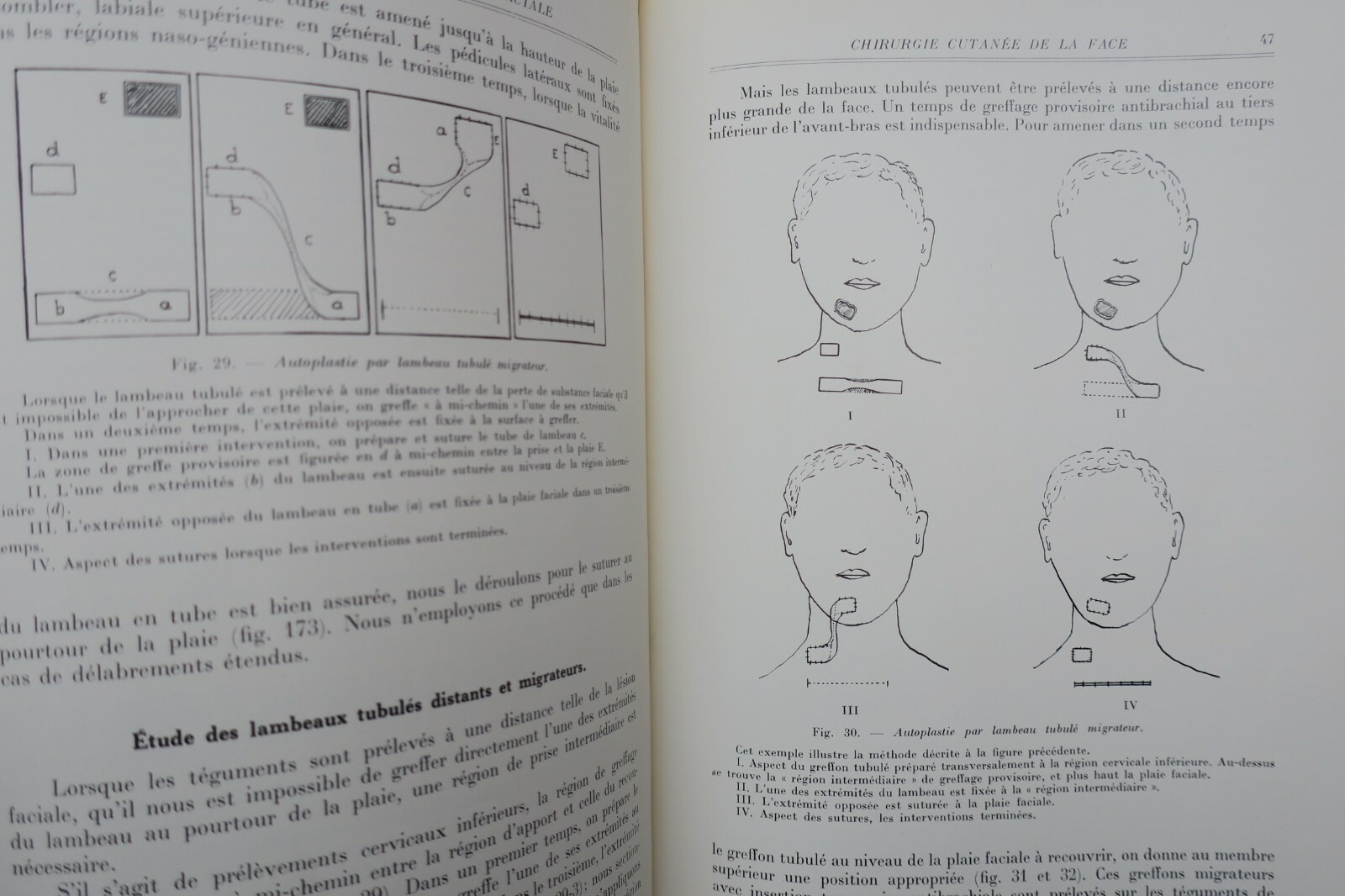 Maxillofacial reconstructive surgery overview - Image 5