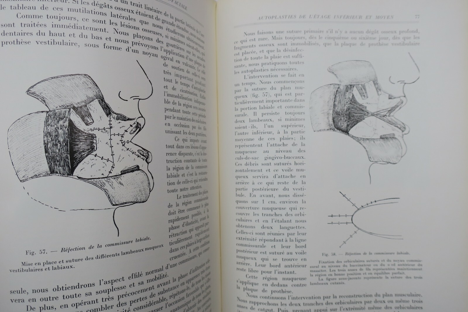 Maxillofacial reconstructive surgery overview - Image 4
