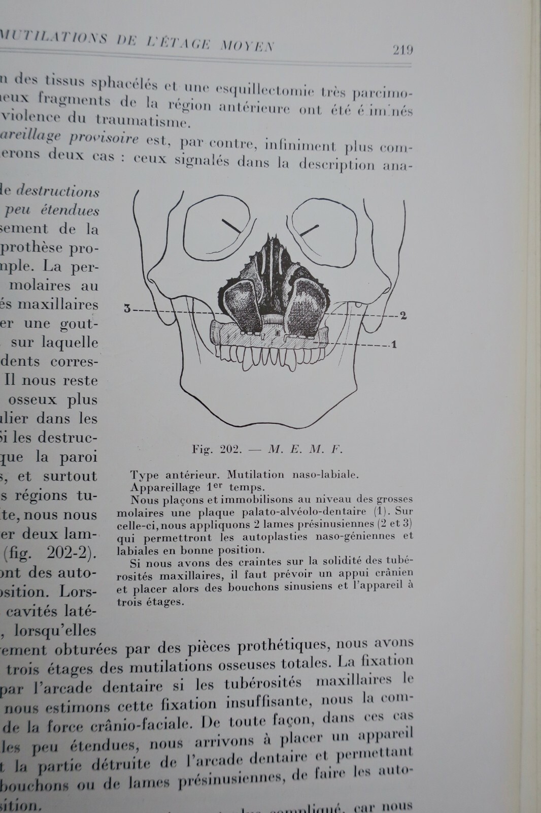 Überblick über die rekonstruktive Kiefer- und Gesichtschirurgie<span class="lla-card-orig-wrap"><span class="lla-card-orig">❦ Chirurgie réparatrice maxillo-faciale. Autoplasties – Prothèse – 1940</span></span> - La Librairie Antique