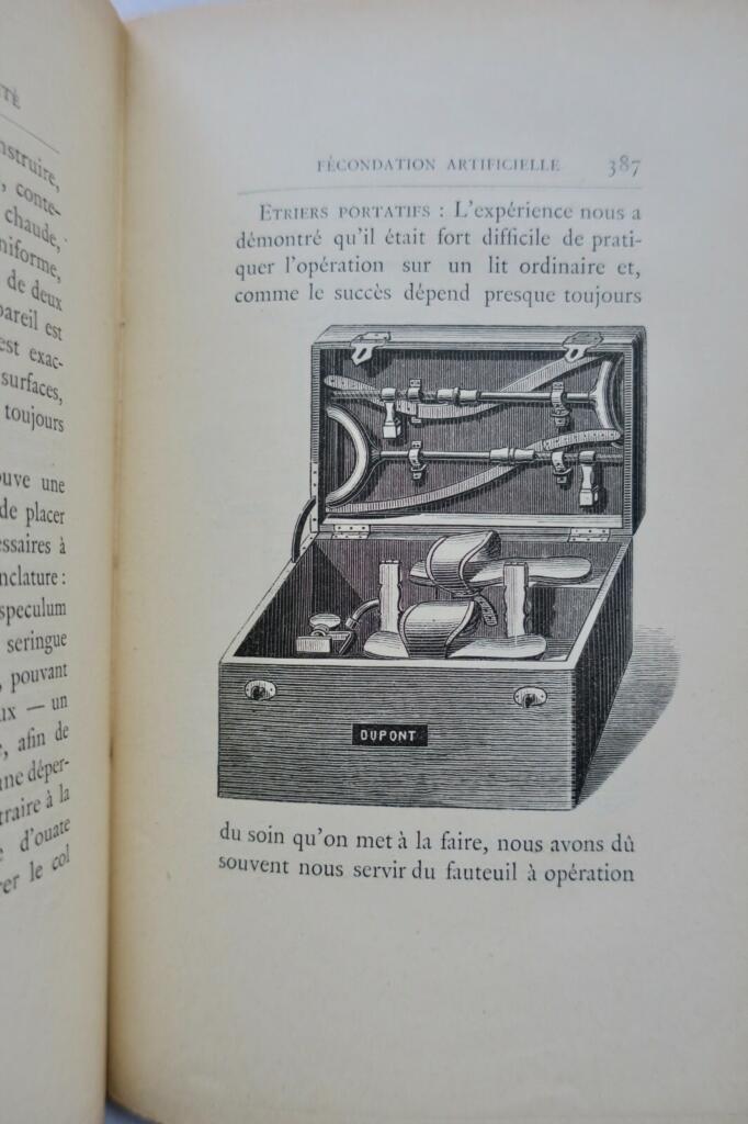 érotique Nouvelles causes de stérilité dans les deux sexes. Fécondation 1888