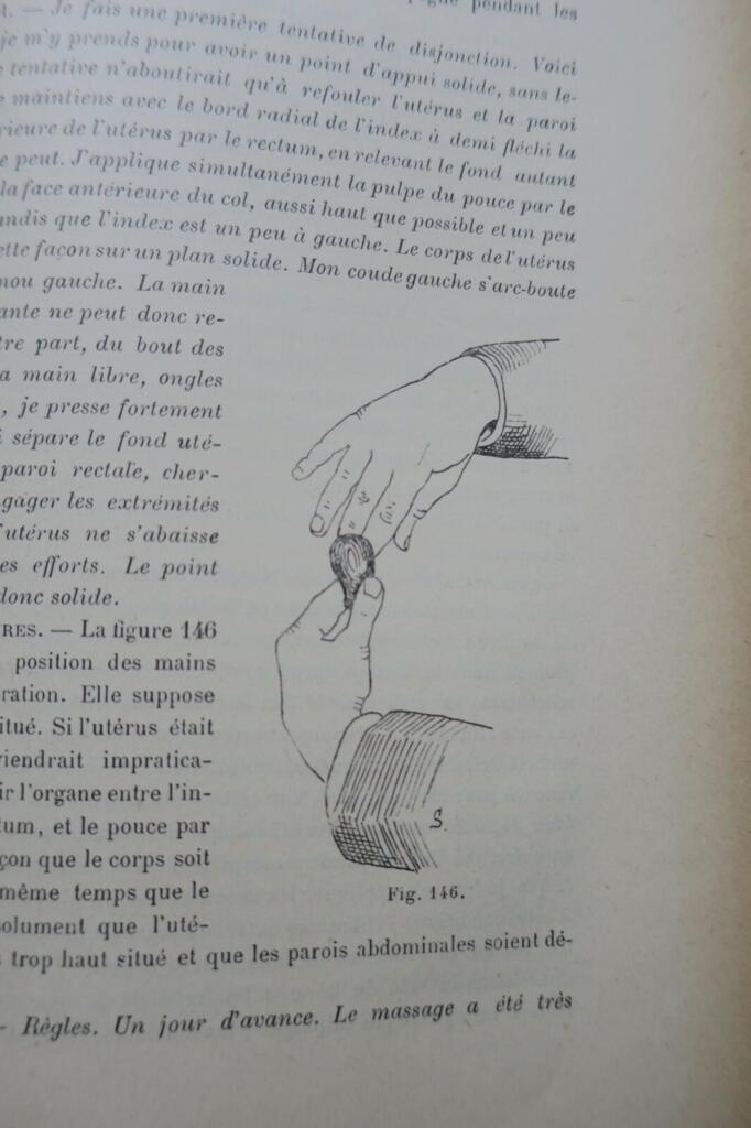 érotique Traité de kinésithérapie gynécologique (massage et gymnastique) 1897