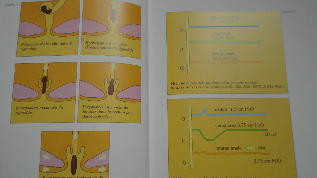 Practical Guide to Constipation Treatment