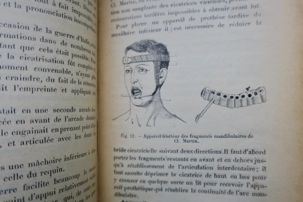 Oral and facial prosthetics and fracture treatment