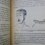 Prothèse restauratrice bucco-faciale et traitement des fractures..1915
