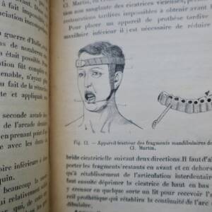 Prothèse restauratrice bucco-faciale et traitement des fractures..1915