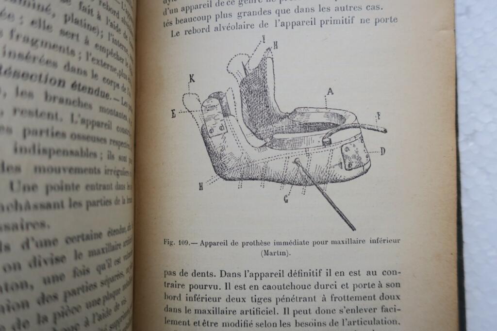 Oral and facial prosthetics and fracture treatment