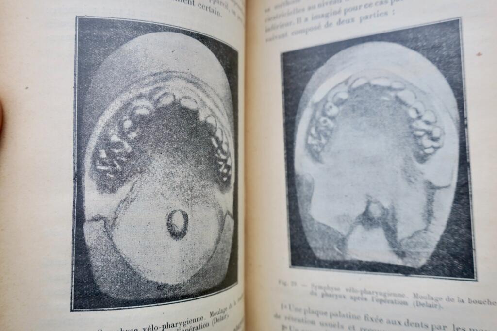 Oral and facial prosthetics and fracture treatment
