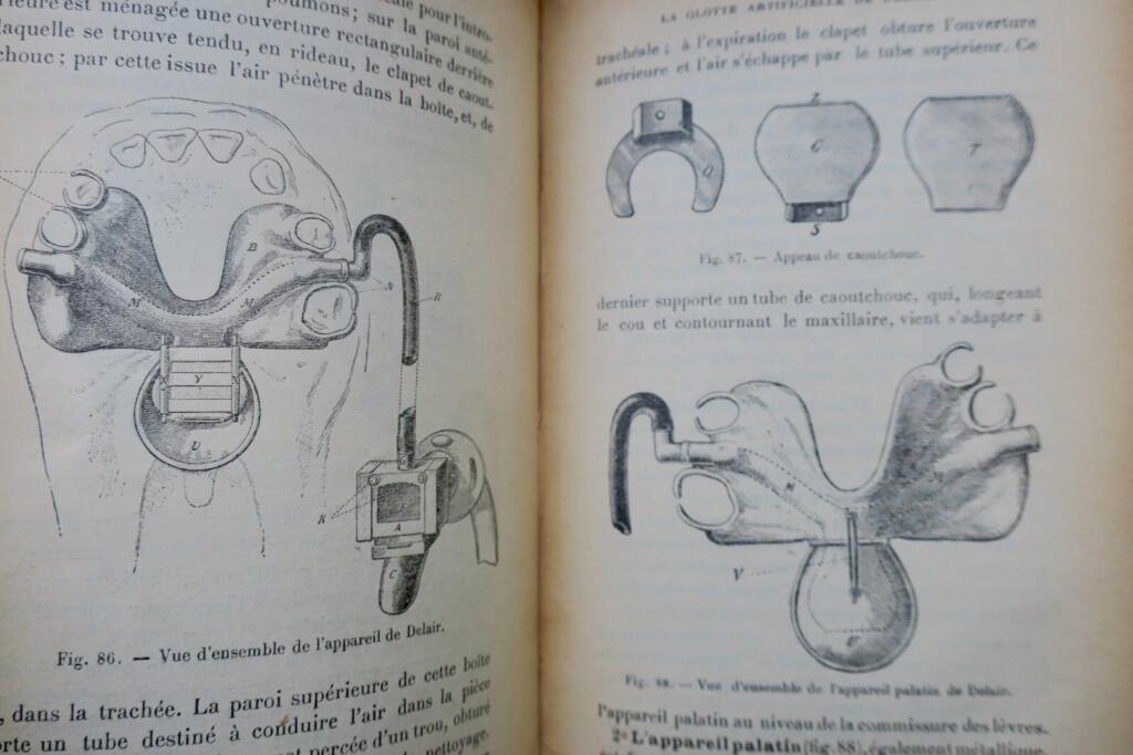 Oral and facial prosthetics and fracture treatment
