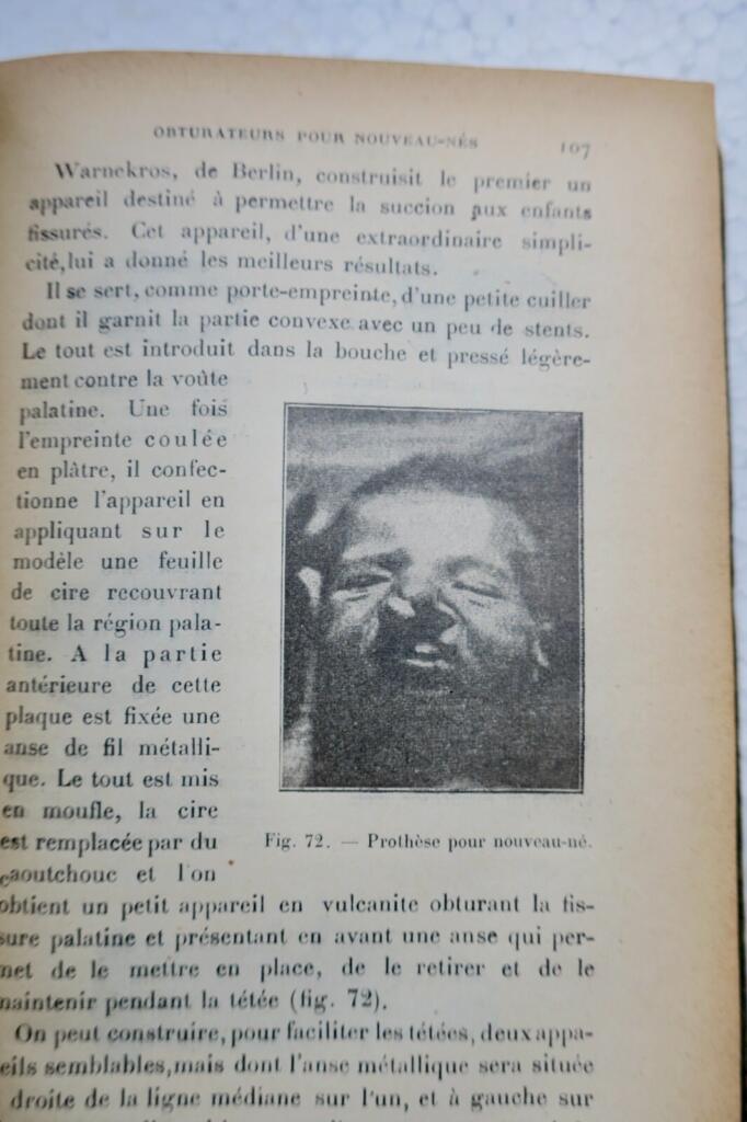 Oral and facial prosthetics and fracture treatment