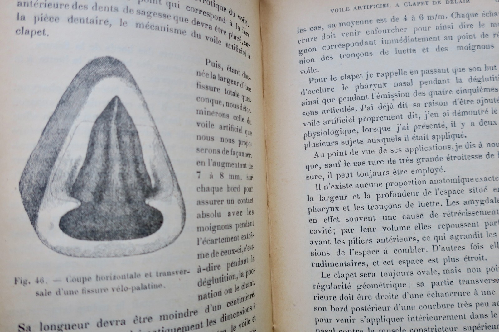 Prothèse restauratrice bucco-faciale et traitement des fractures..1915 – Image 7