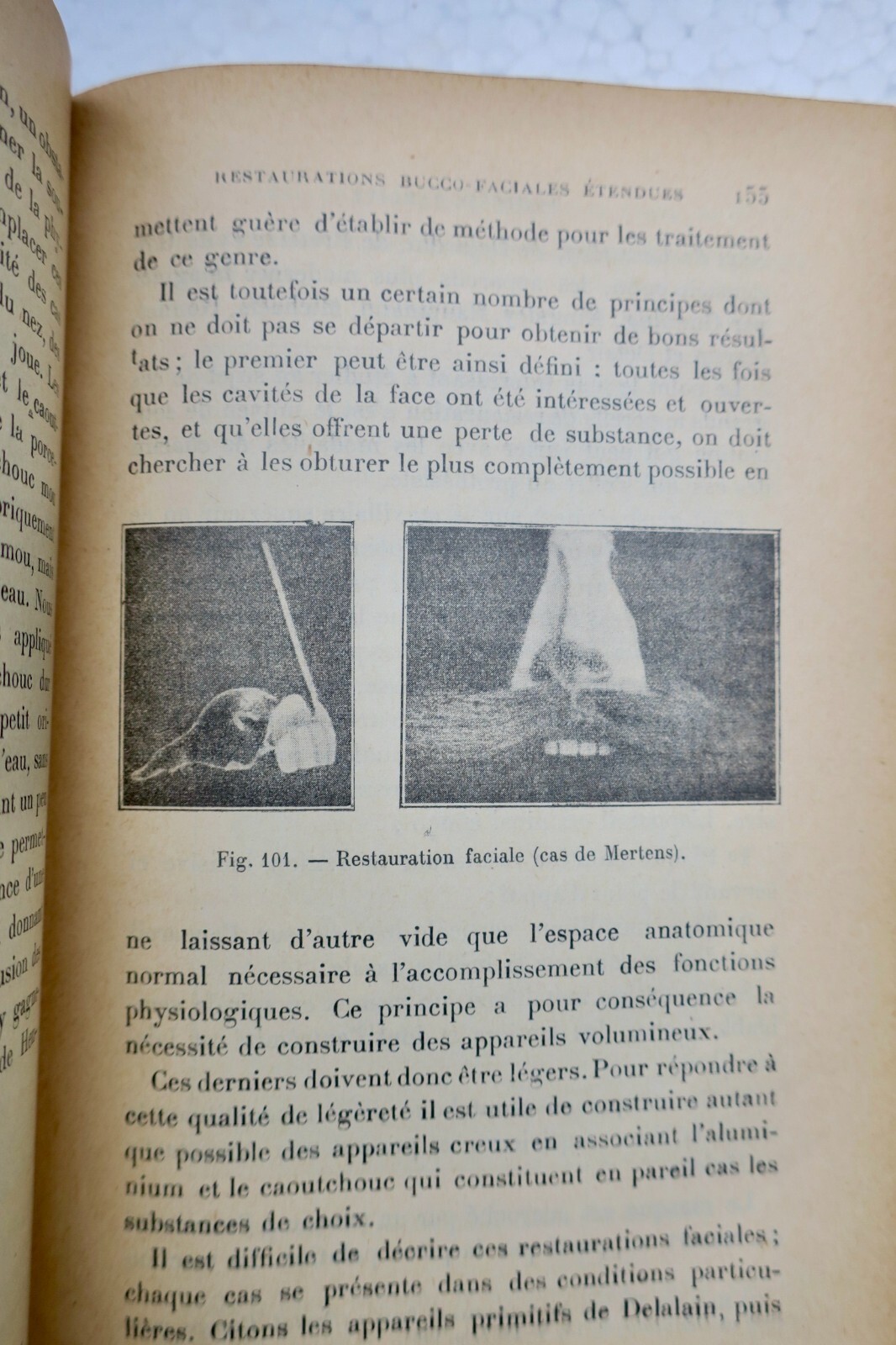 Prothèse restauratrice bucco-faciale et traitement des fractures..1915 – Image 5