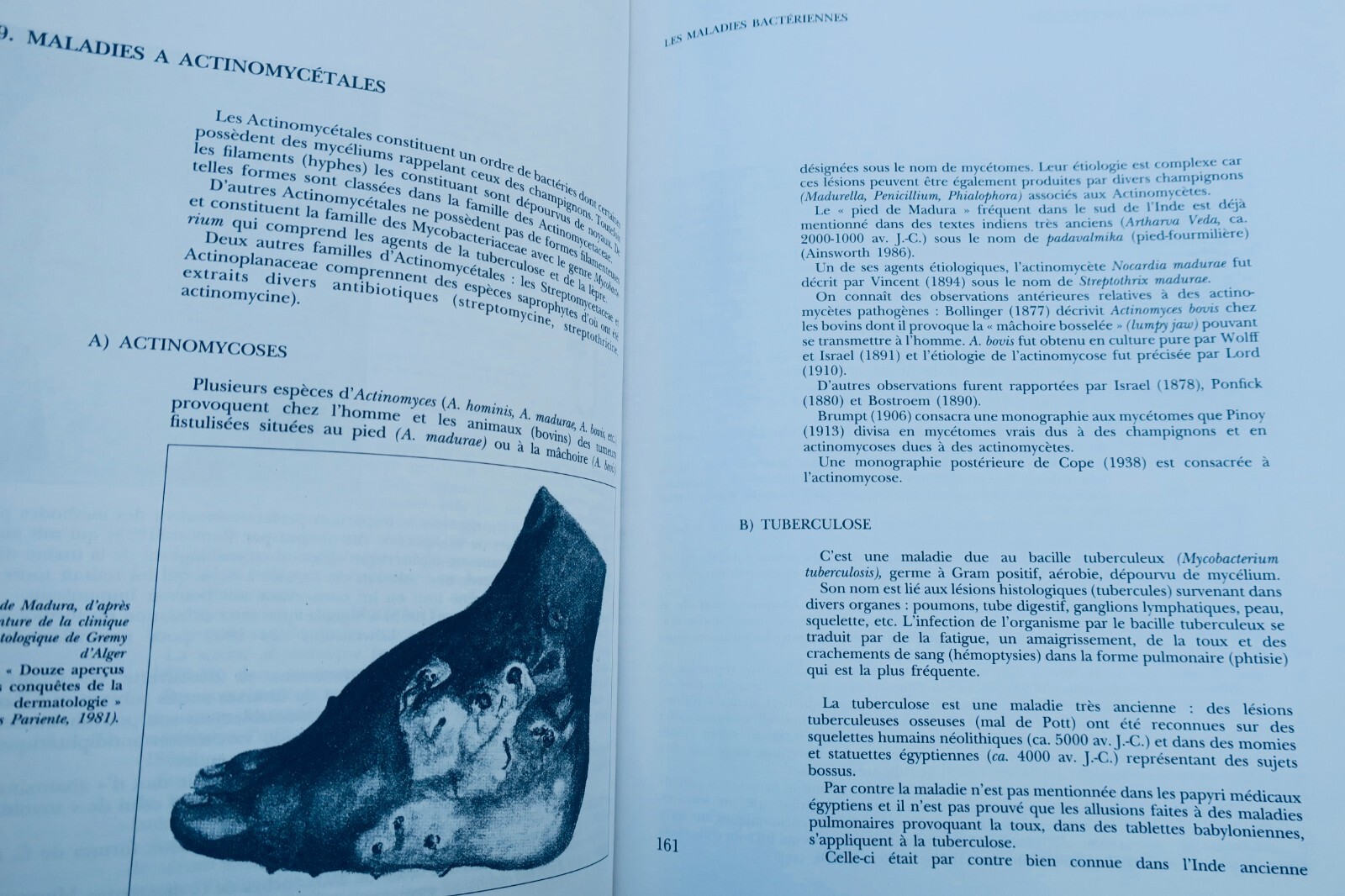 From Miasma to Virus: Infectious Disease History - Image 8