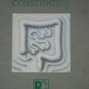 Practical Guide to Constipation