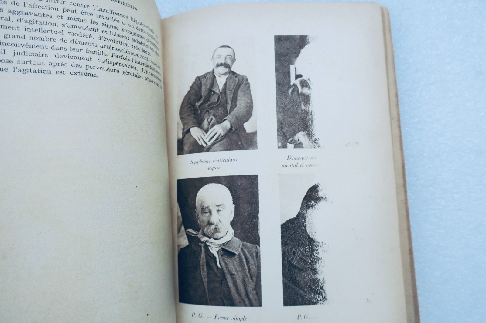 Psychiatrie für den praktischen Arzt 1922