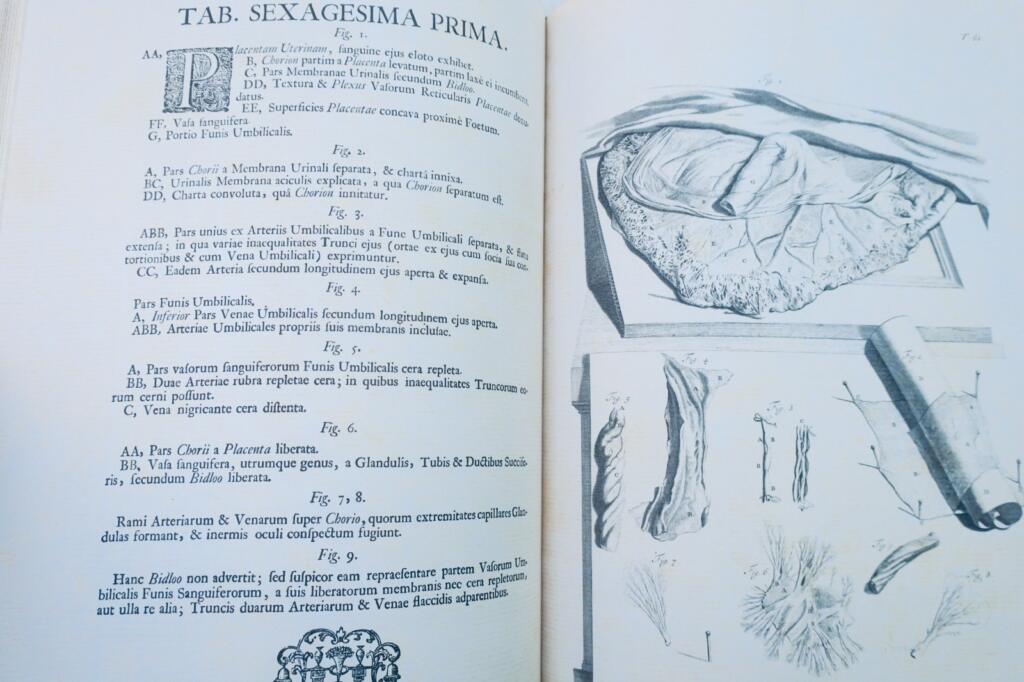 Anatomia corporum humanorum centum et viginti tabulis 1750