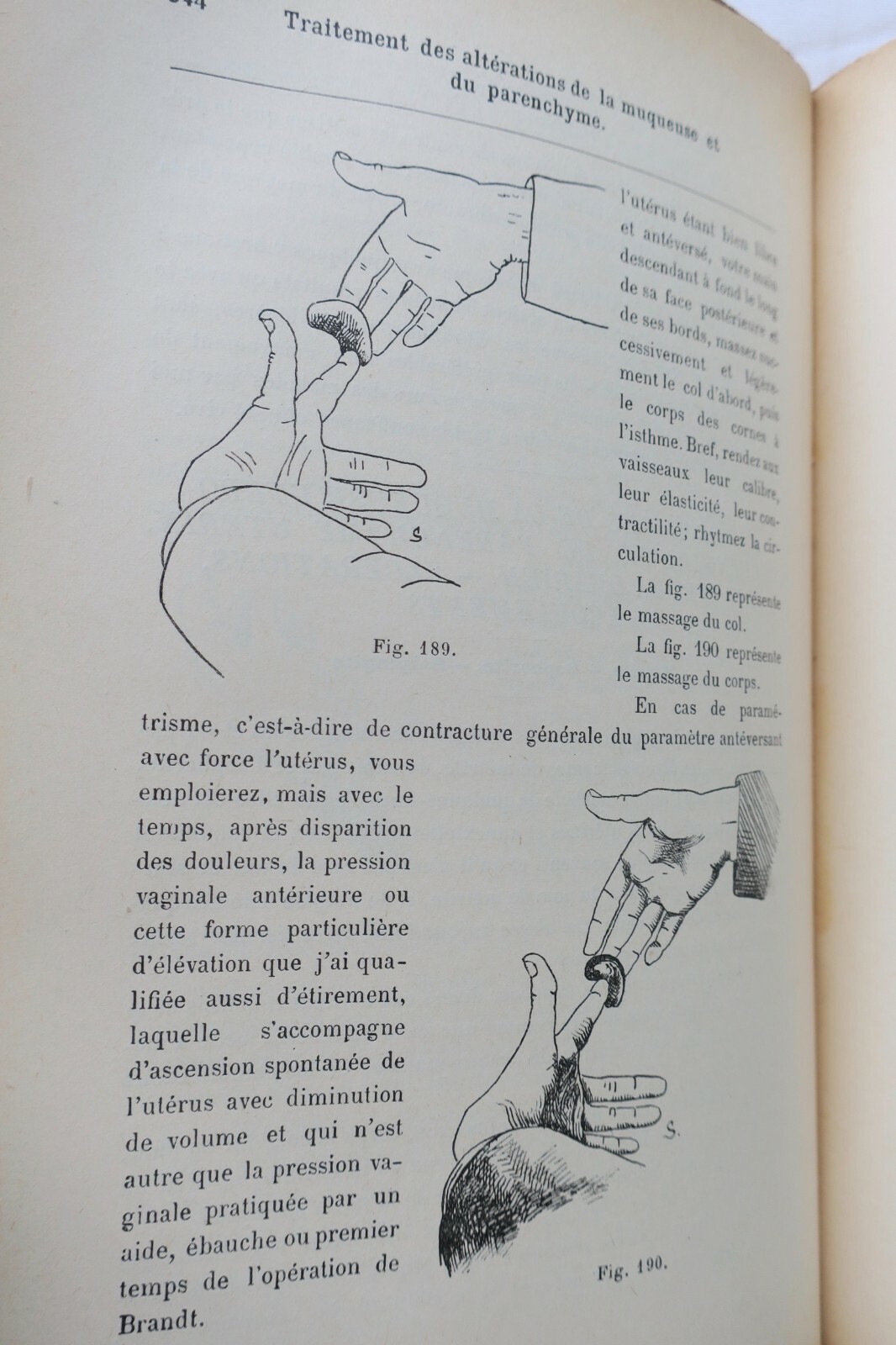 Erotischer Traktat über gynäkologische Kinesitherapie (Massage und Gymnastik), 1897