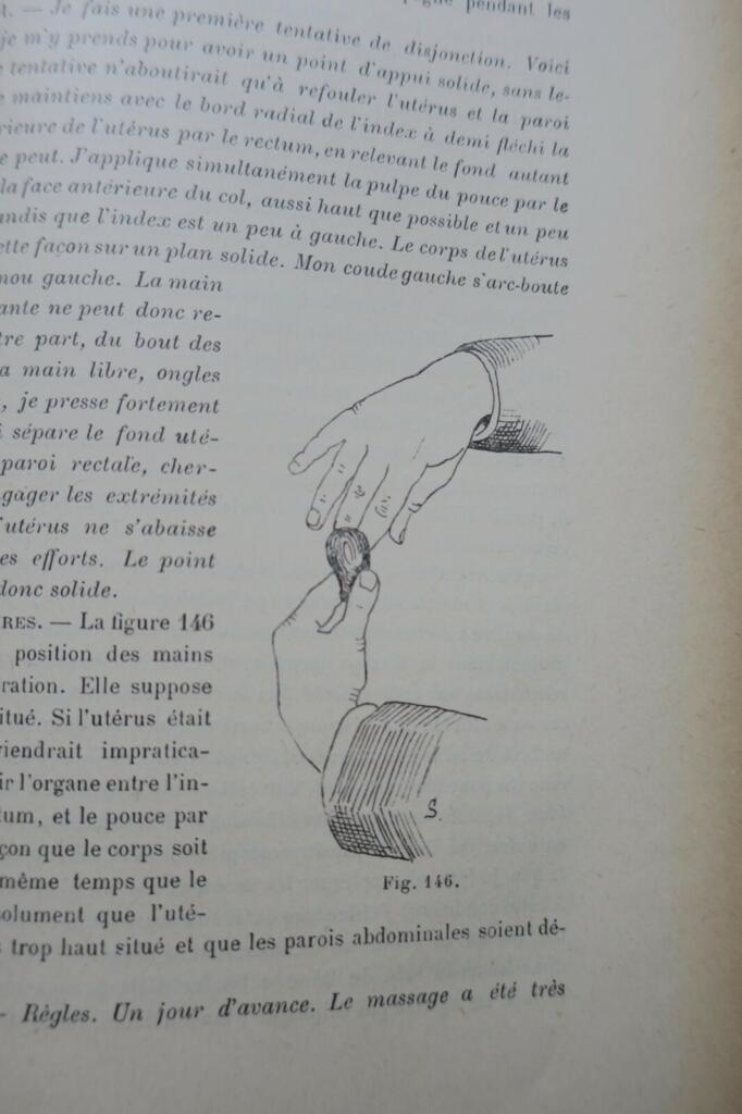 érotique Traité de kinésithérapie gynécologique (massage et gymnastique) 1897