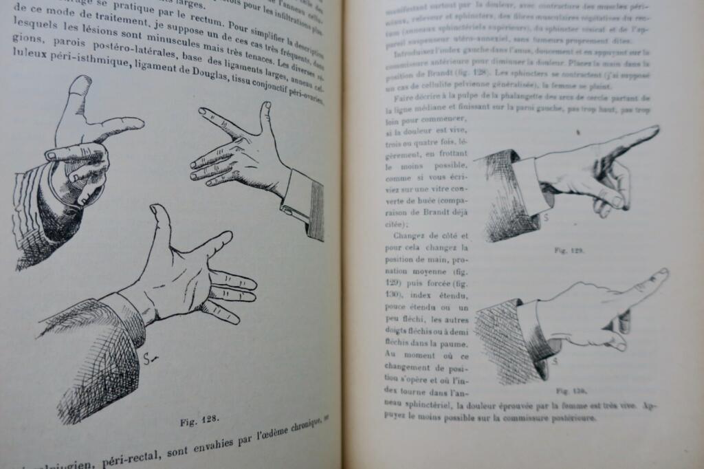 érotique Traité de kinésithérapie gynécologique (massage et gymnastique) 1897