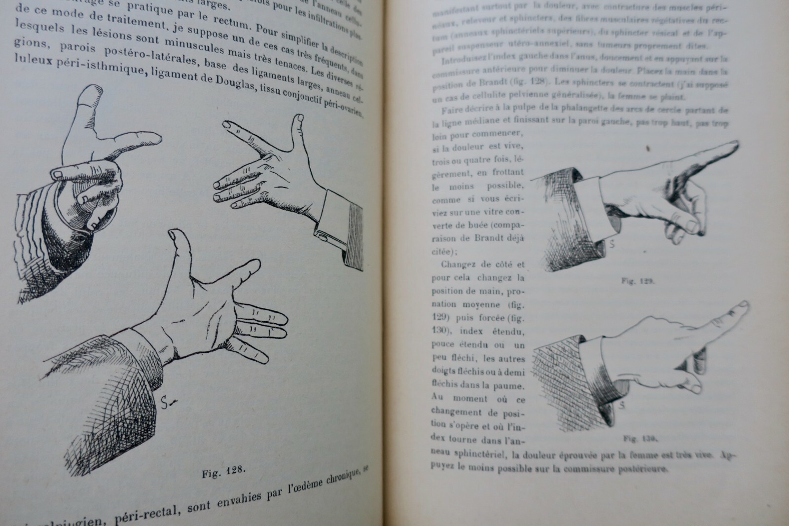 Erotischer Traktat über gynäkologische Kinesitherapie (Massage und Gymnastik), 1897
