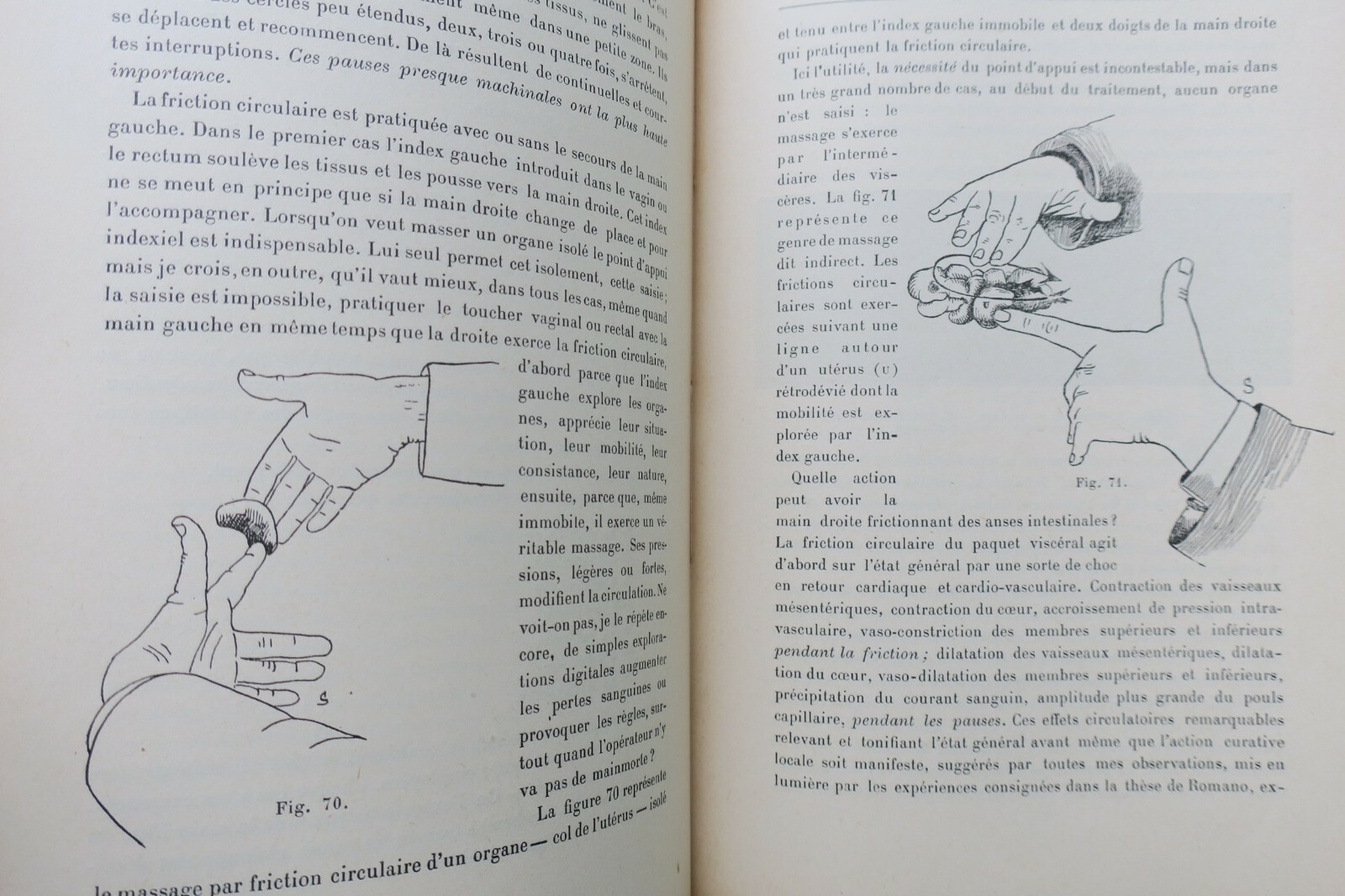 Erotischer Traktat über gynäkologische Kinesitherapie (Massage und Gymnastik), 1897