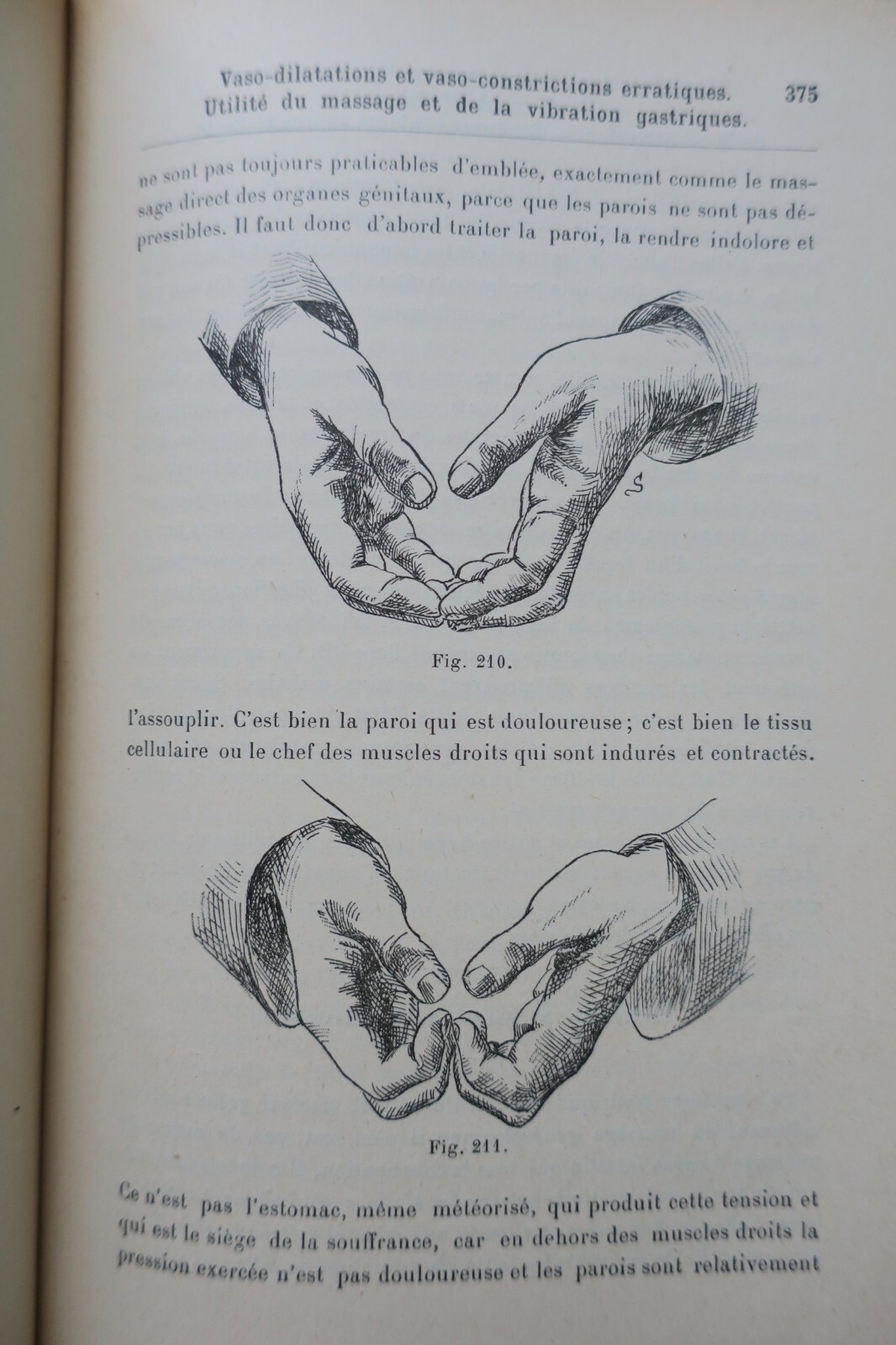 Erotischer Traktat über gynäkologische Kinesitherapie (Massage und Gymnastik), 1897