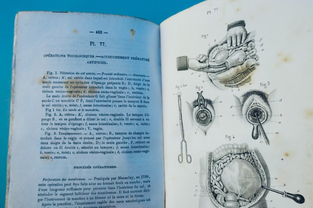 anatomie Bernard & Huette Précis iconographique de médecine opératoire 1846
