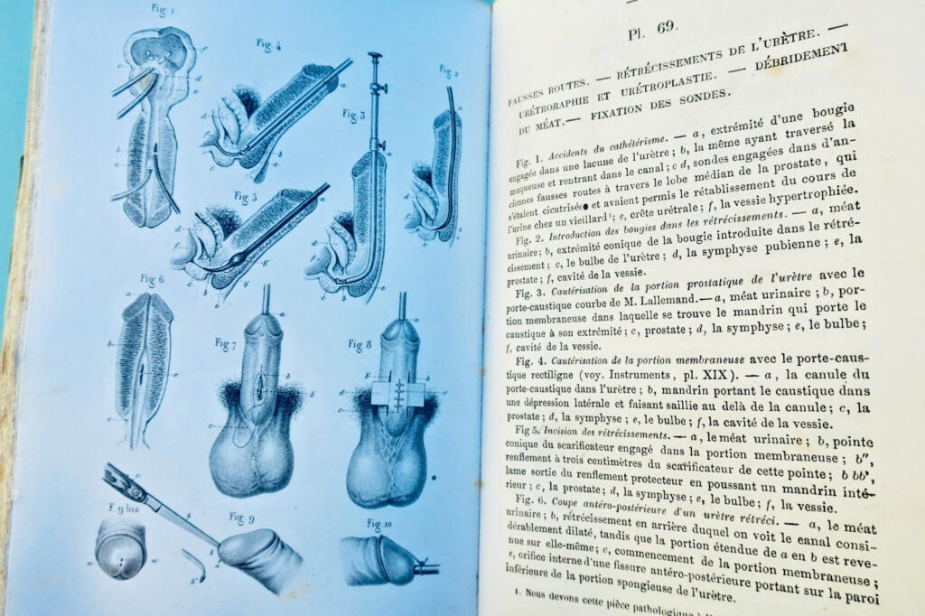anatomie Bernard & Huette Précis iconographique de médecine opératoire 1846