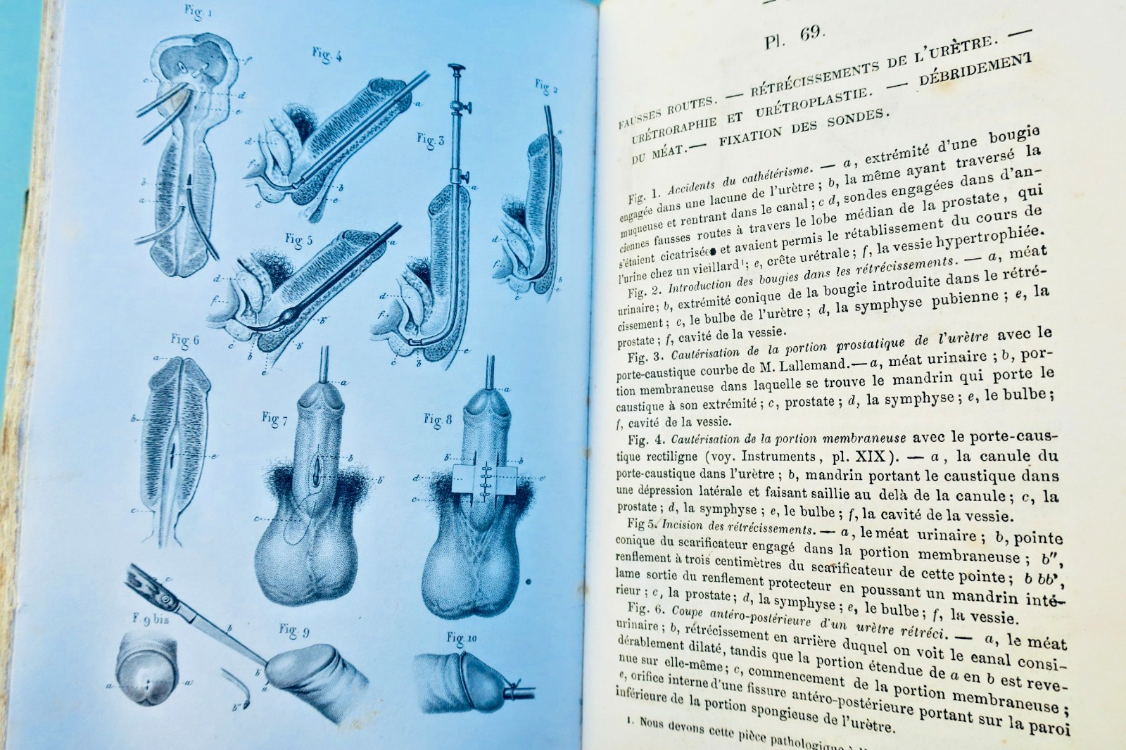 anatomie Bernard & Huette Précis iconographique de médecine opératoire 1846 (vue 2 sur 9)